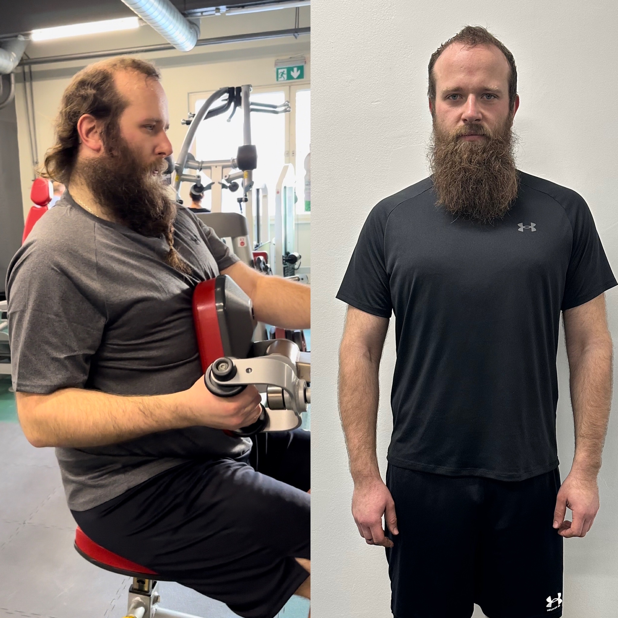 before after