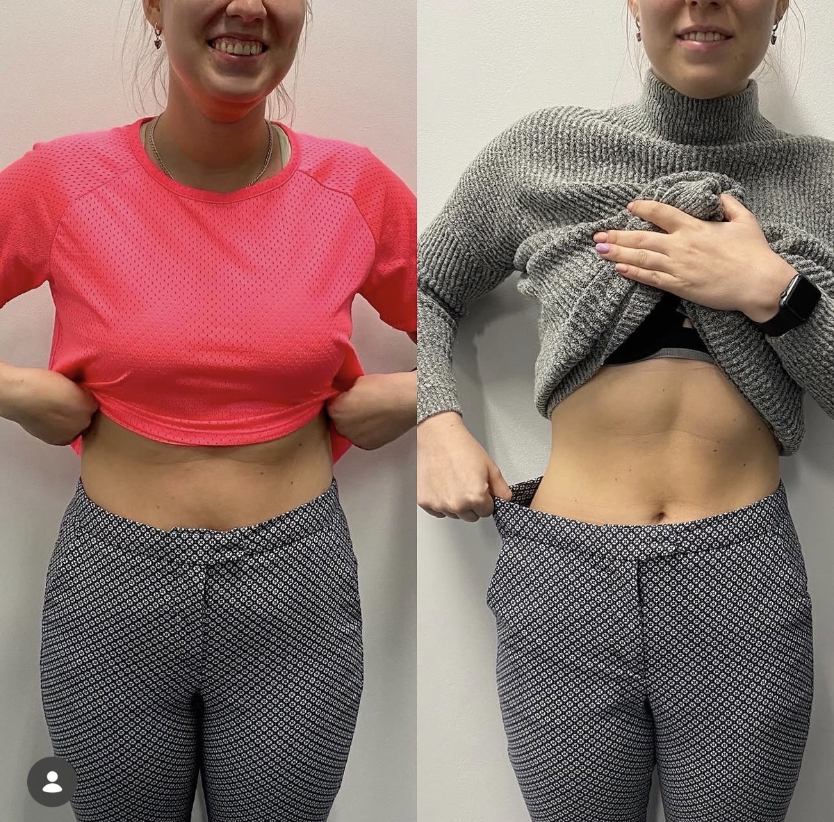 before after